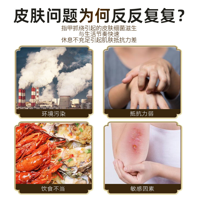 硫磺抑菌乳膏皮肤瘙痒洗头膏疥虫 金湖雅家居皮肤消毒护理（消）