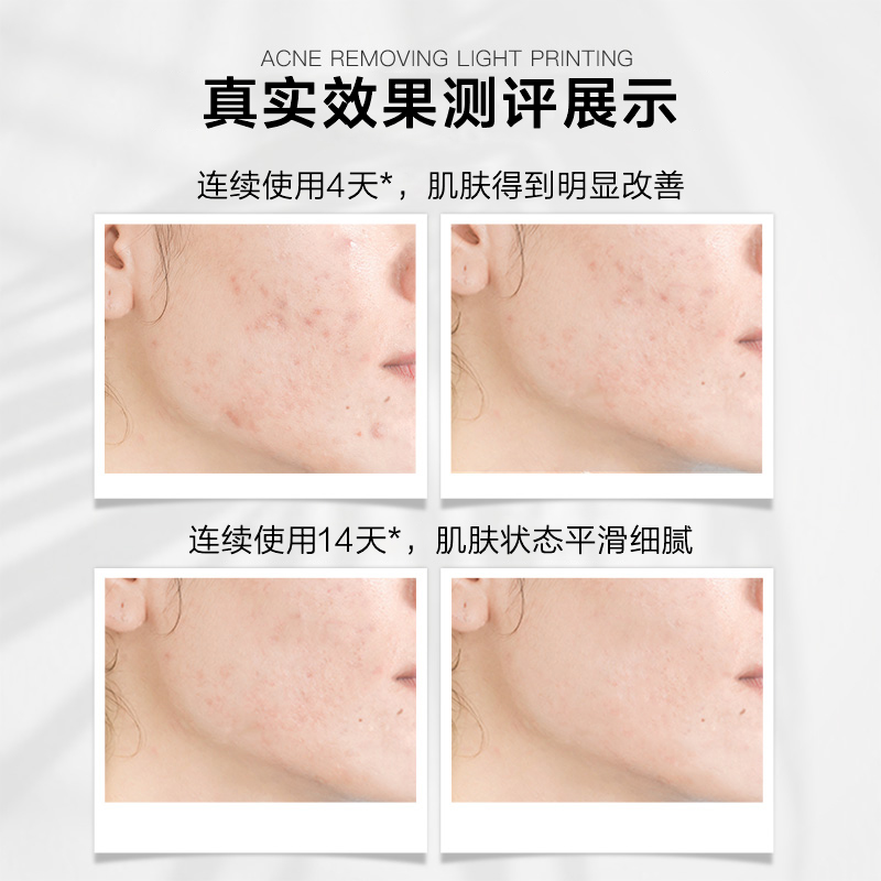 阿芙官方旗舰店阿芙澳洲茶树精油精华笔 精华液面部精华脸部平衡水油修护0