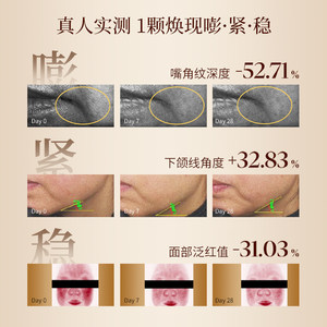 阿芙木乃伊双萃丸A醇抗皱紧致精油面部次抛精华