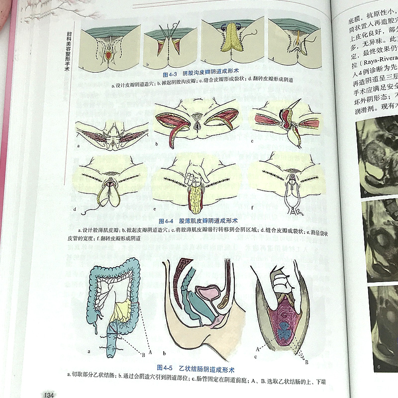 正版包邮妇科美容整形手术李强李峰永主编中国协和医科大学出版社妇科整形美容手术原则技巧妇科整形临床经验书籍-图2