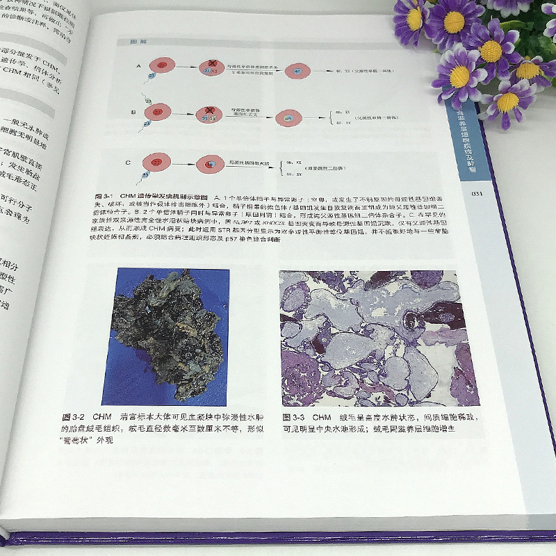 正版包邮胎盘诊断病理学国内外数十位妇产科病理专家心血之作凝结多所妇产科医院胎盘诊断病理精华北京科学技术97875714205-图0