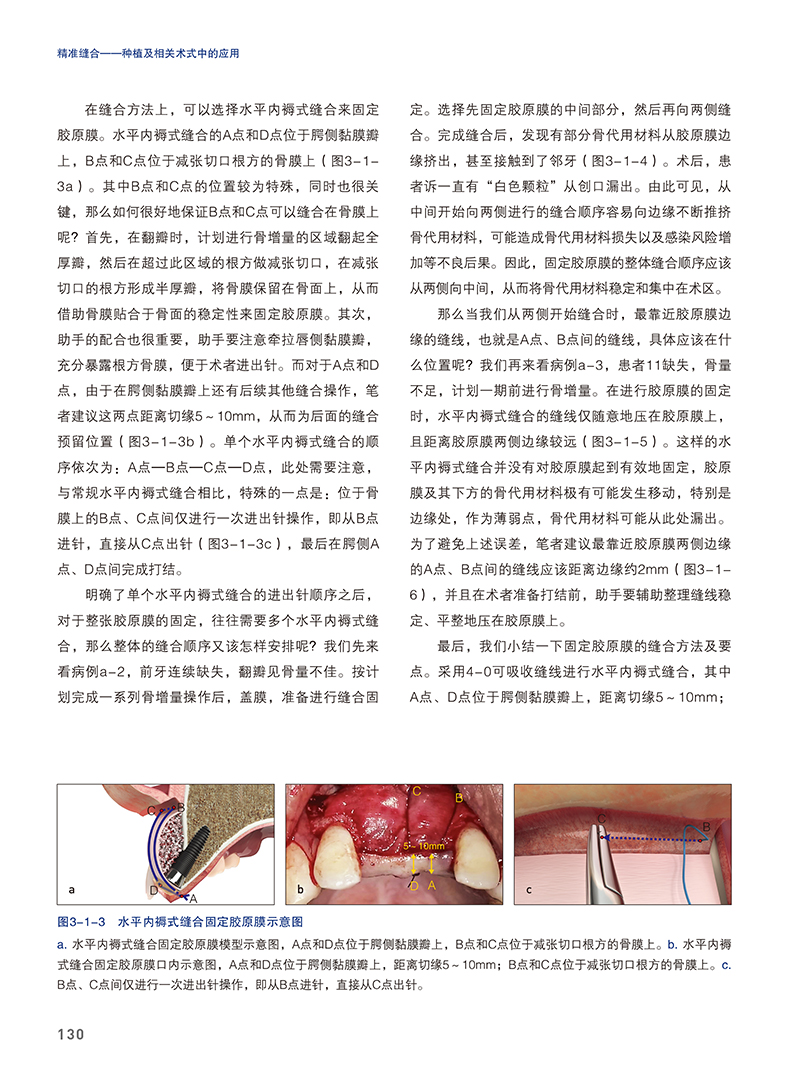 正版包邮 精准缝合 种植及相关术式中的应用 满毅 主编 口腔牙医修复正畸口腔科学书籍 辽宁科学技术出版社 9787559126115 - 图2