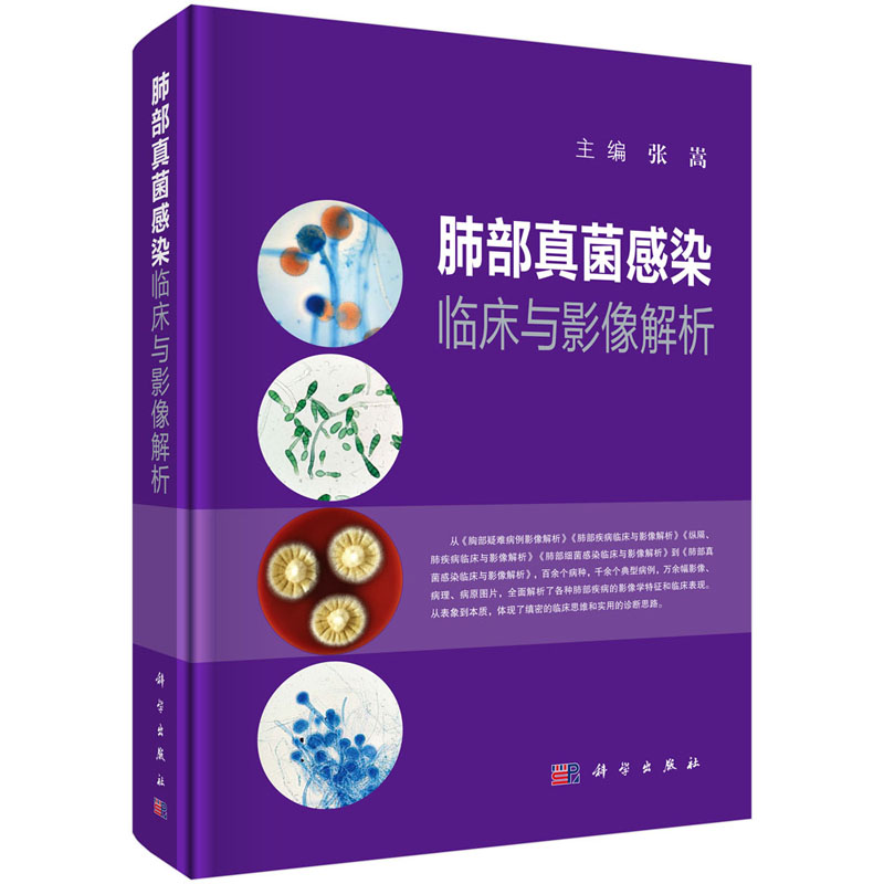 2本套 肺部细菌感染临床与影像解析+肺部真菌感染临床与影像解析 肺部几大类细菌感染的临床表现和影像特点 科学出版社