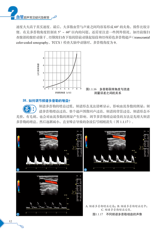 正版包邮 血管超声常见疑问及解答 贲志飞陈赛君 血管疾病超声波诊断问题解答 超声影像书籍 科学技术文献出版社 - 图3