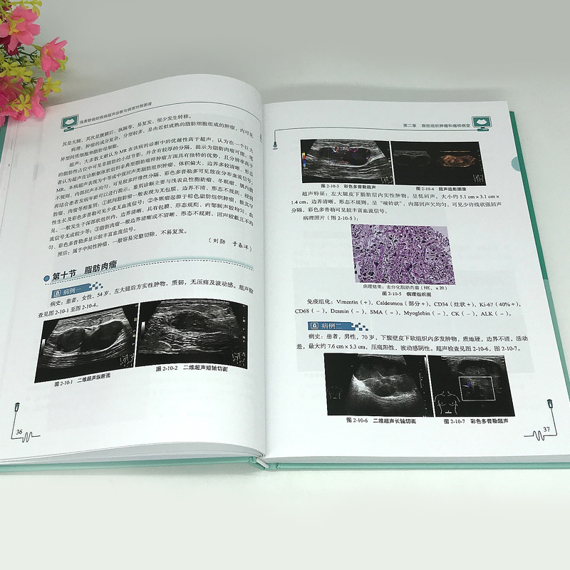 正版包邮 浅表软组织疾病超声诊断与病理对照图谱 刘勋 魏玺 临床医学 超声学书籍 9787518973743 科学技术文献出版社 - 图2