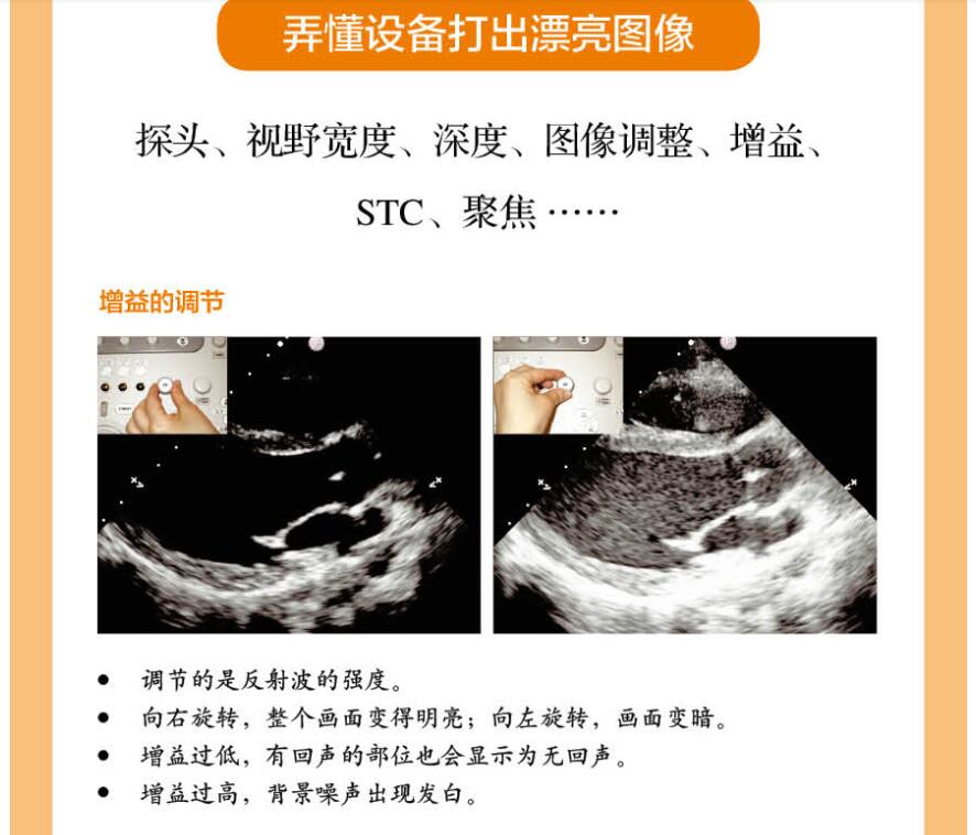 超声解剖及扫查技巧图解 超声医学规培教材书籍超声入门书超声诊断学影像医学书超声科临床专业教材书临床超声疾病诊治基础教程书 - 图3