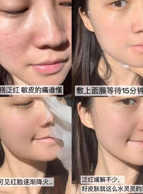 宣壹美芙乳凝钙美力修护舒缓面膜