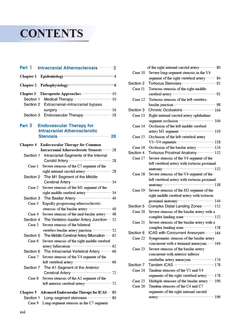 颅内动脉粥样硬化性狭窄血管内介入治疗 马宁 中英双语对照 ICAS研究血管内治疗技术临床精选病例9787565926969北京大学医学出版 - 图3