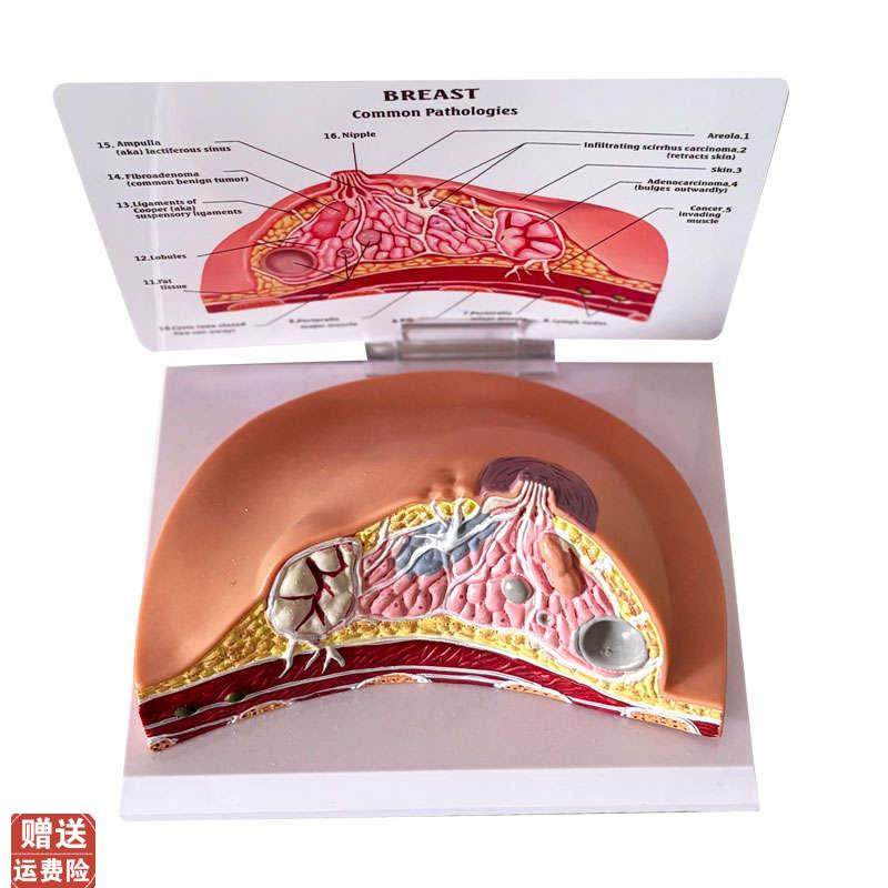 乳房模型乳腺增生家政培训妇产乳腺E演示哺乳期乳房构造催乳师教,淘宝优惠券,粉丝福利购,淘宝优惠卷