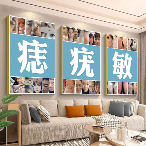 男女面痣图点痣海报脸部取痣宣传画植物古方祛痣图祛斑祛疣广告图 - 图2