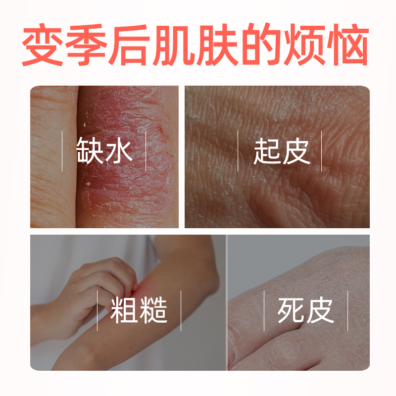 脚医生手足皲裂液膏皲裂干裂粗糙裂口脚后跟干裂非凡士林非修复霜