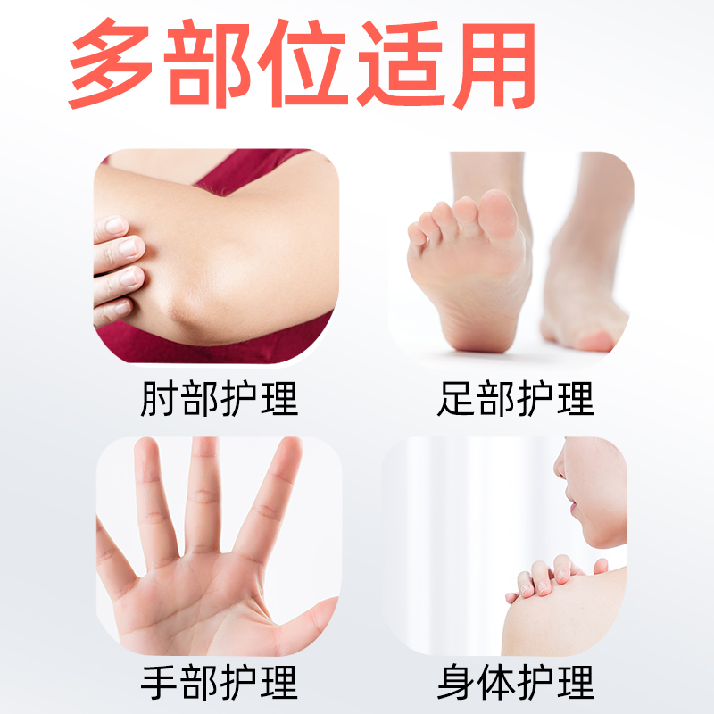 脚医生手足皲裂液膏皲裂干裂粗糙裂口脚后跟干裂非凡士林非修复霜