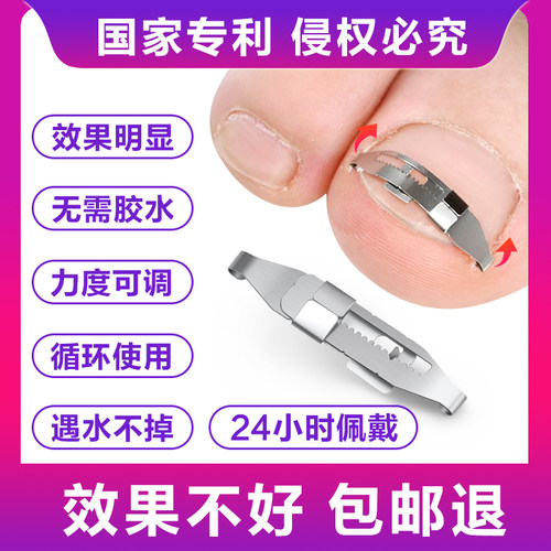 正甲扣甲沟矫正器正甲贴片脚趾甲嵌甲卷甲指甲长肉里修纠正神器炎 - 图0