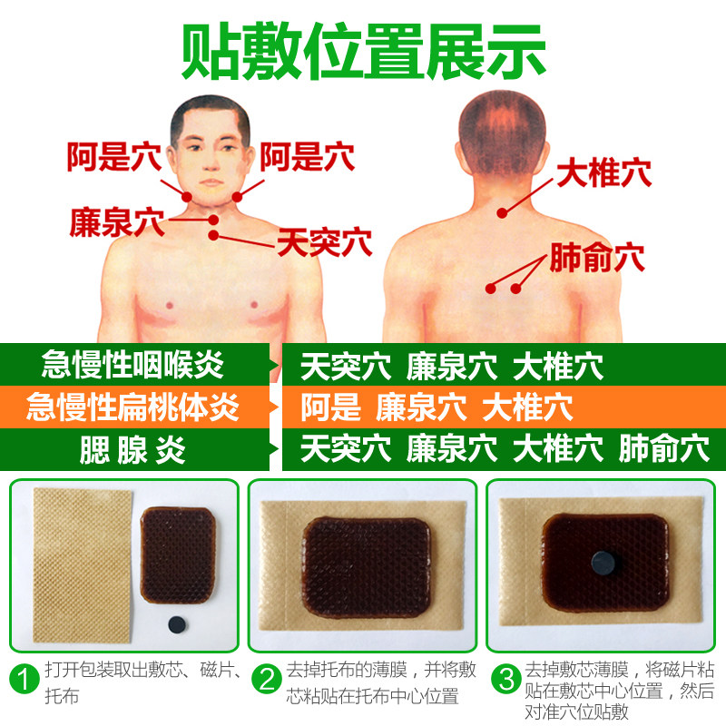 咽扁清急慢性咽喉炎穴位磁疗贴 护康医疗器械膏药贴（器械）