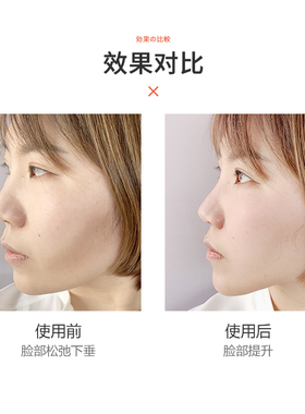 miko酱日本瘦双下巴提拉挂耳硅胶V脸提拉紧致修容无痕