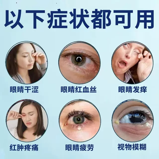 过敏性结膜炎眼药水缓解视疲劳模糊洗眼液眼睛干涩发痒疼痛SK-图1