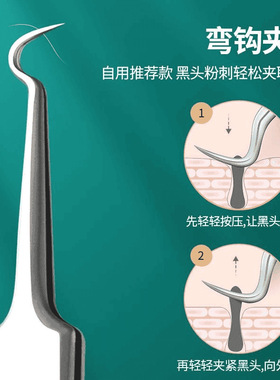 【榜单热销款】进口粉刺清洁工具去黑头细胞夹祛痘闭口镊子粉刺针
