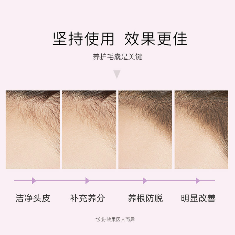 博柔固发防脱洗发水侧柏叶头皮护理清爽脂溢性脱发洗头膏液男女