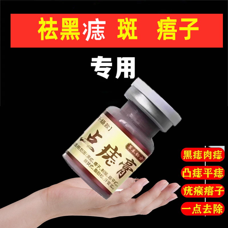 儿童可用去痣点痣膏祛痣正品旗舰店脸部除瘊子痦子黑点肉粒药膏水 - 图0