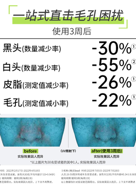 【专属优惠】cnp希恩派去黑头鼻贴膜*1组 紧致毛孔去黑头