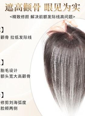 刘海片女头顶补发遮白发