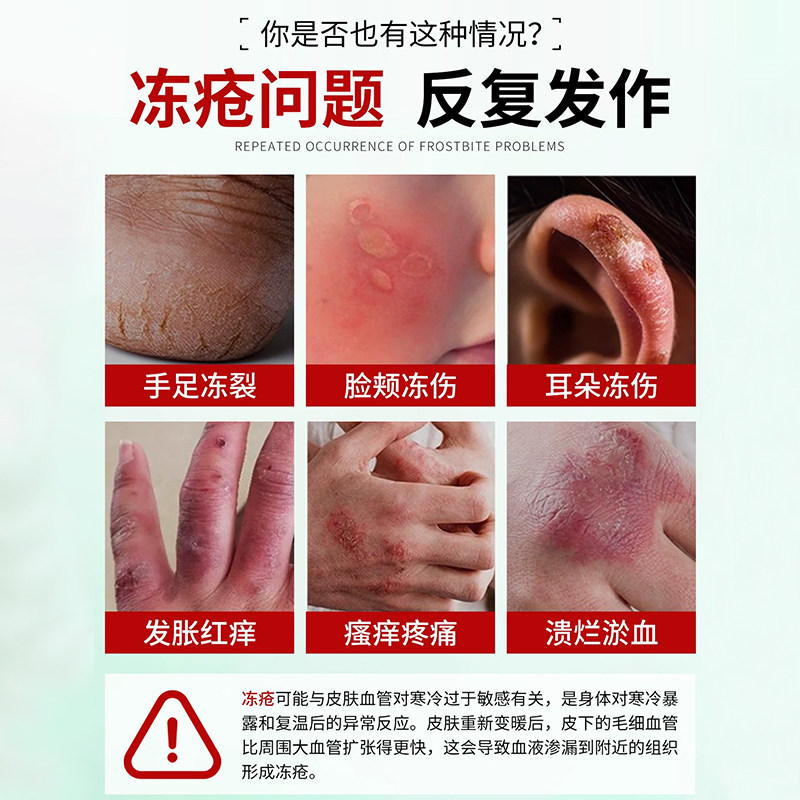 云南本草冻疮膏排行榜第一名止痒冻伤膏正品官方旗舰店抑菌膏儿童,淘宝优惠券,粉丝福利购,淘宝优惠卷