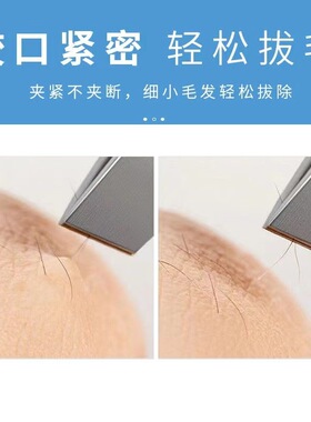 眉夹小镊子斜口修眉全套加厚眉毛夹子专用胡子修眉夹拔毛双眼皮