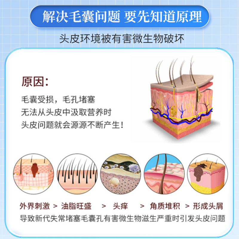 毛囊炎头部专用长疙瘩头发头痒长头皮痘痘脸上药膏溢脂性头癣瘙痒 - 图0