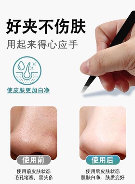 精工拔胡子镊子|回头客超1000人