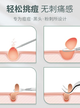 去黑头镊子粉刺针细胞夹刮闭口