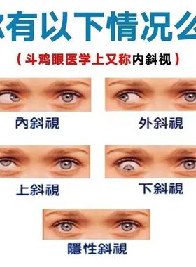 近视控眼部按摩器纠正斜视改善内斜外斜斗鸡眼弱视