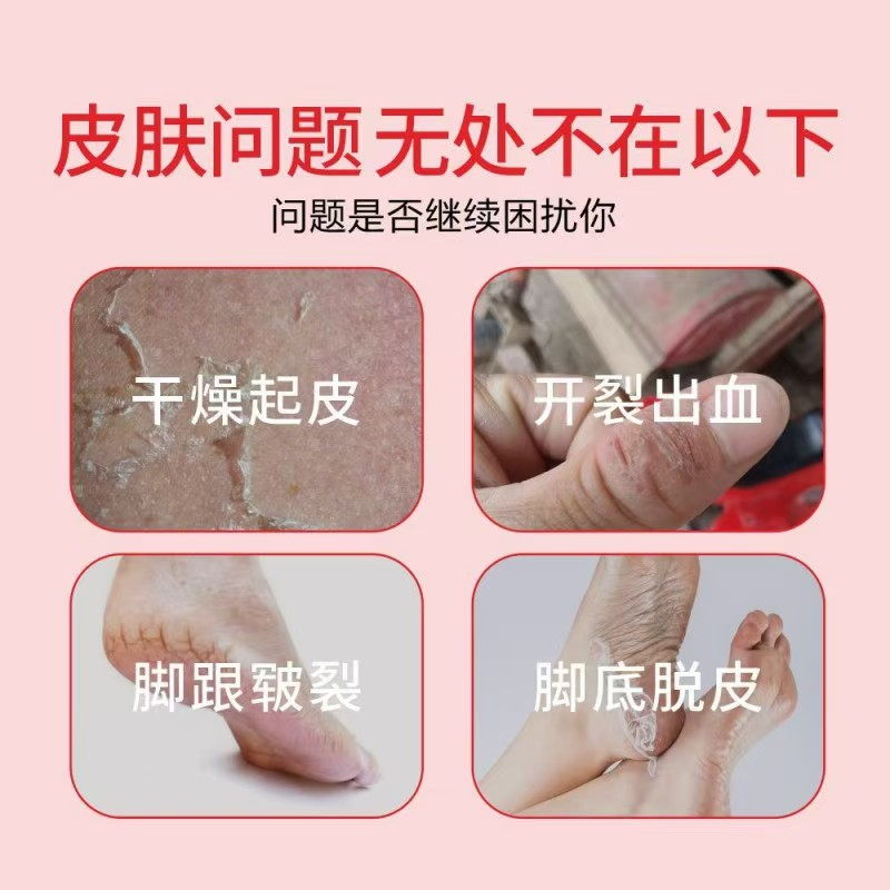 红花冻裂蛇油膏冻疮乳膏止痒冻伤膏正品耳朵防冻霜手足脸防冻防裂,淘宝优惠券,粉丝福利购,淘宝优惠卷