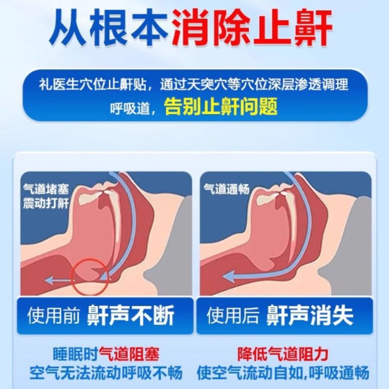 礼医生止鼾贴D型正品砭贴官方旗舰店非打呼噜止鼾减轻鼾声-图0