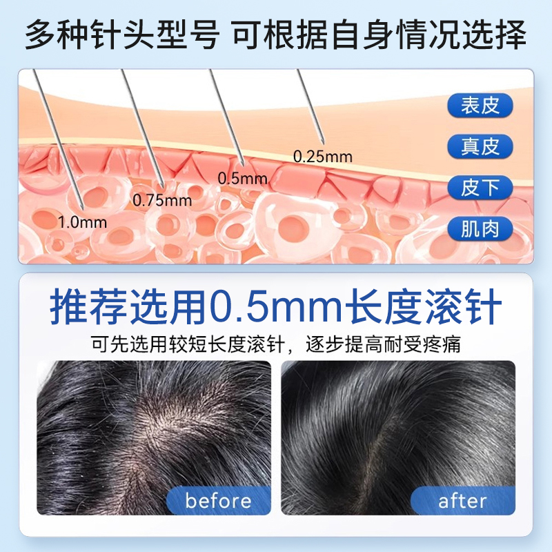 滚针医用械字号米诺地尔头皮上药器微针滚轮生发一次性酊泡沫剂液 - 图2
