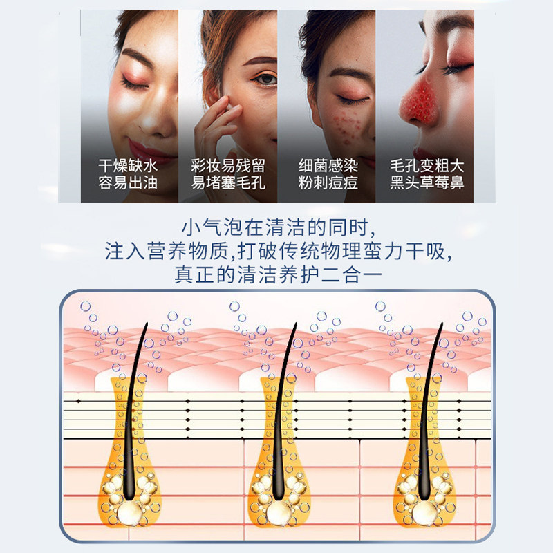 吸黑头神器小气泡电动美容仪器脸部毛孔清洁去粉刺神器美容院同款,淘宝优惠券,粉丝福利购,淘宝优惠卷