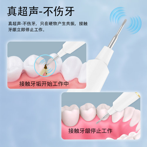 超声波电动洗牙器家用牙结石去除器洁牙器牙科口腔专用除牙石神器 - 图1