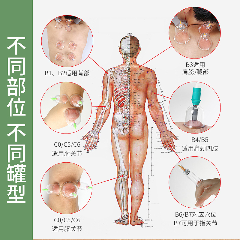 康祝正品家用拔罐器抽气式真空散罐单个大小号膝盖关节u型异性罐