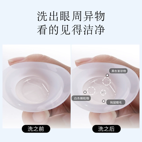 Сияющие глаза промыты глаза глазные круги устало