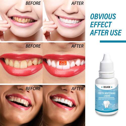 Teeth Whitening Essence Liqud Oral Hygiene Cleaning Whiten - 图0