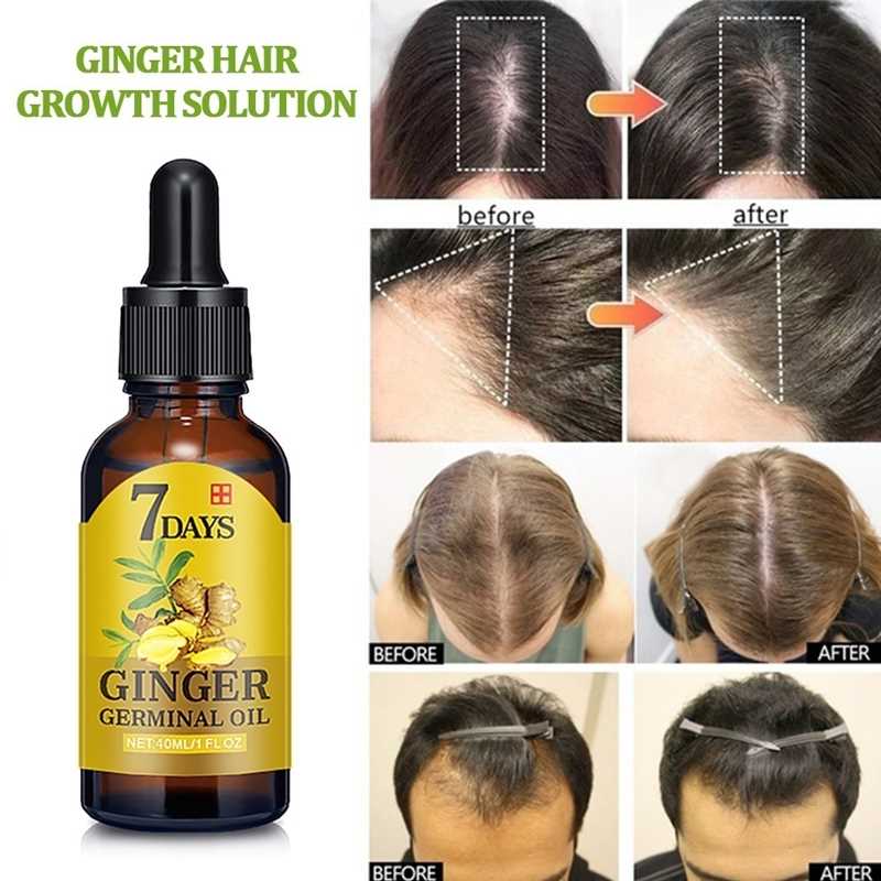 7 day Ginger Hair Growth Nutrient Solution Hair Loss Treatme - 图2