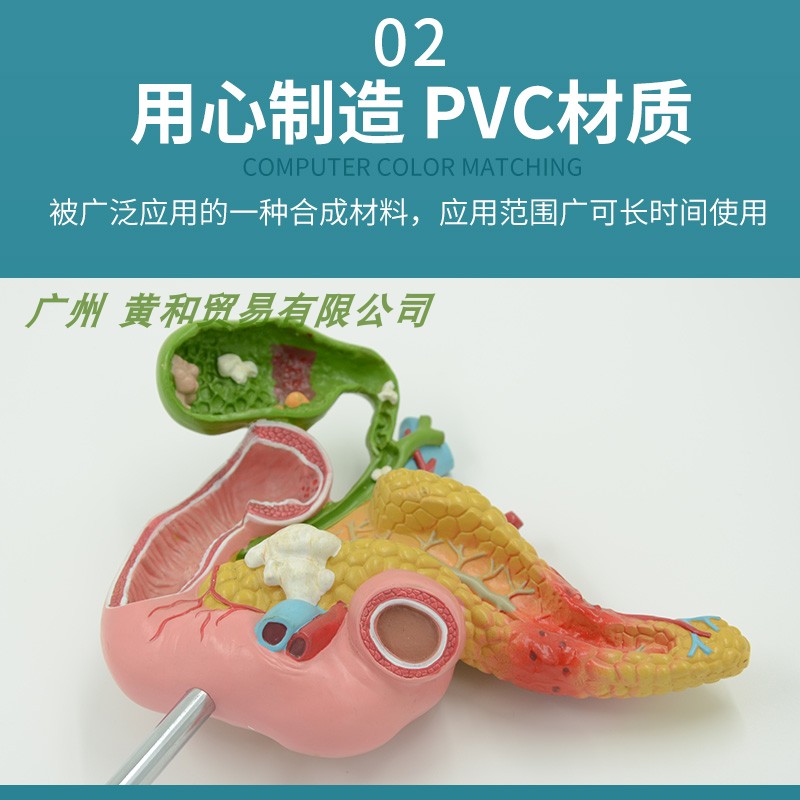 黄河胰腺十二指肠胆囊病理模型胆结实消化系统模型肝医学-图1