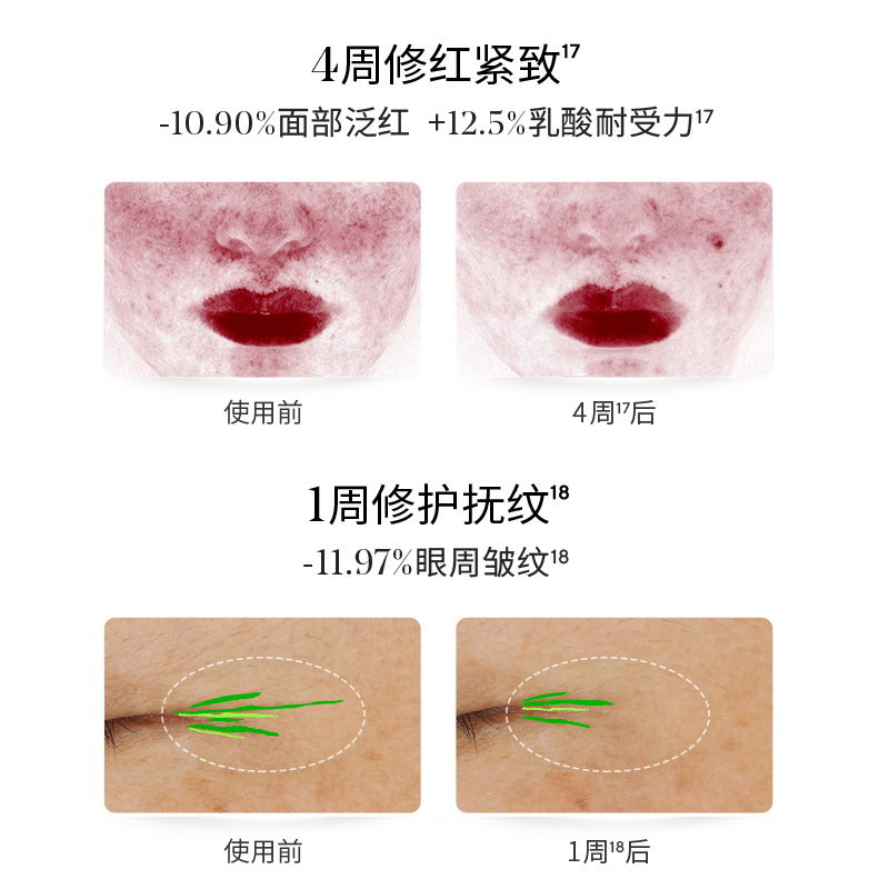 【618现货开抢】Murad慕拉得omega精华 抗老修护紧致修红敏感肌 - 图2