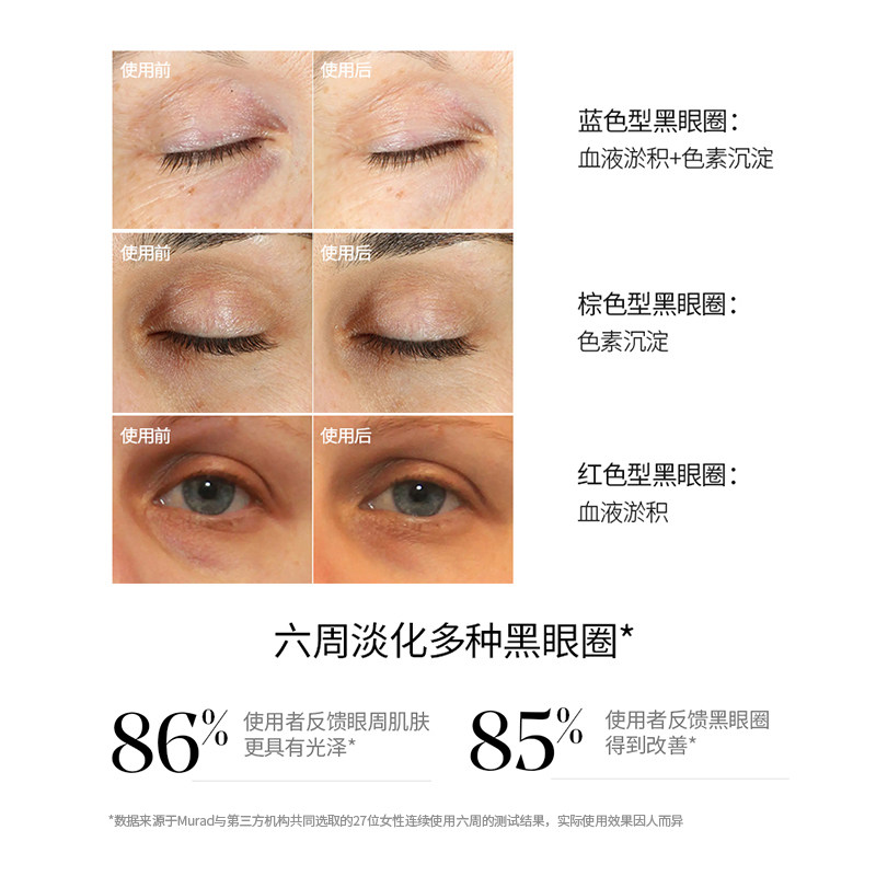  Murad海外眼霜