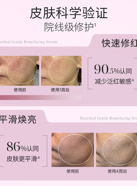 Murad慕拉得神经酰胺精华
