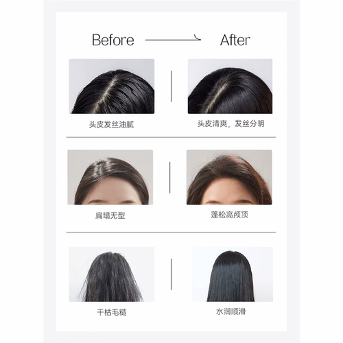 spes海盐玻尿酸洗发水洗发露女洗护套装男士诗斐丝控油蓬松洗头膏 - 图0