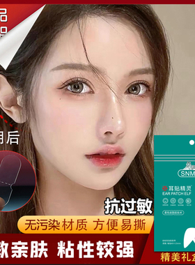 精灵耳贴耳贴医用硅胶不过敏