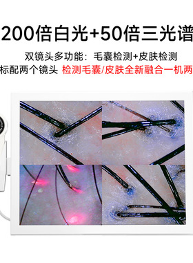 15寸四分格头皮检测仪高清一体机