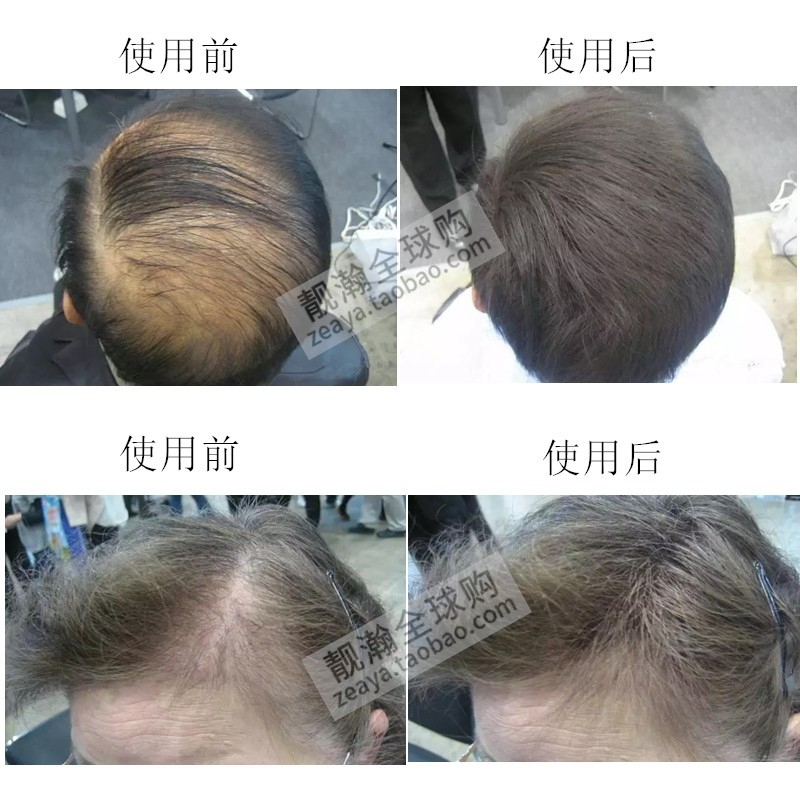 日本迷丽发SUPER MILLION HAIR增发纤维假发喷雾遮秃补头发密发粉-图3