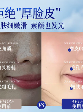丁家宜去角质啫喱去死皮面部温和补水保湿滋润不紧绷不拔干男女士
