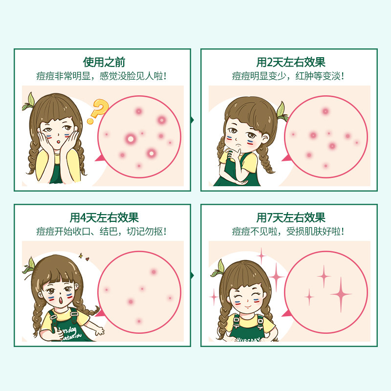 星期四农庄茶树祛痘凝胶套餐洁面露 星期四茶树面部护理套装